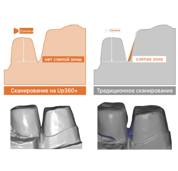 Стоматологический 3D сканер Up360+
