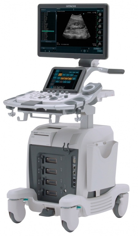 УЗИ аппарат Hitachi arietta 65