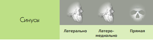 14.PNG