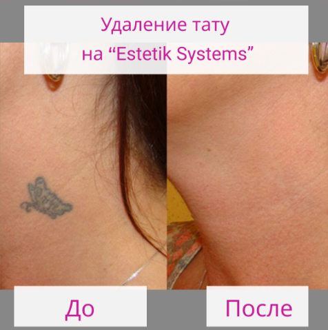 e6cd8d980d0935fb3c0381df3eaedb9c.png