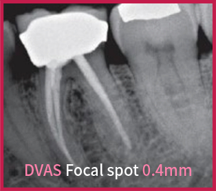 dvas-clearimg-img2.png