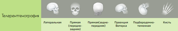 876.PNG